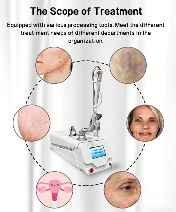 JY-FL5 CO₂ Fractional Laser: Product Results Demonstration Image 2